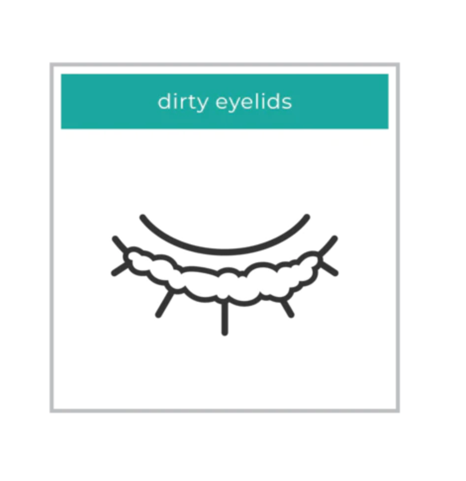 WE LOVE EYES Eyelid Margin Cleansing Brush WE LOVE EYES Eyelid Margin Cleansing Brush - 